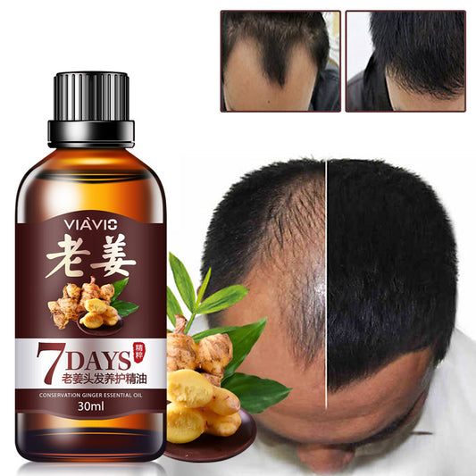DAGEDA New Ginger Hair Growth Oil Essence, Stops Hair Loss, Dense Thicken Hair, Balding Supports Healthy Hair Growth for Women & Men-30ml - Buy 3 Pay For 2