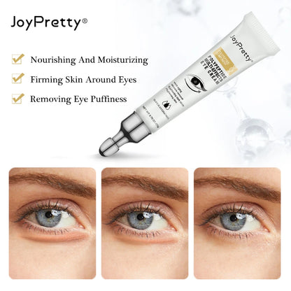 Crema para ojos JOYPREETY: Elimina ojeras, bolsas y arrugas para una mirada más luminosa (20 g)