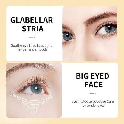 ROREC Snail Extract Anti-Winkle Eye Cream