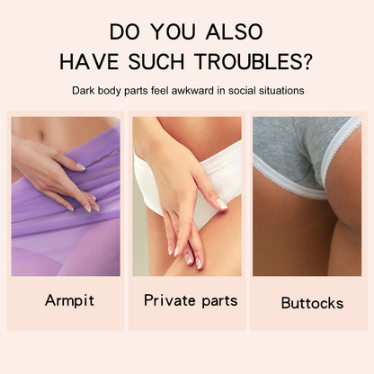 LUNOON Whitening Cream Private Parts Underarm Bleaching Serum Whiten Butt Knee Brighten Inner Thigh Intimate Parts Dark Remove Melanin