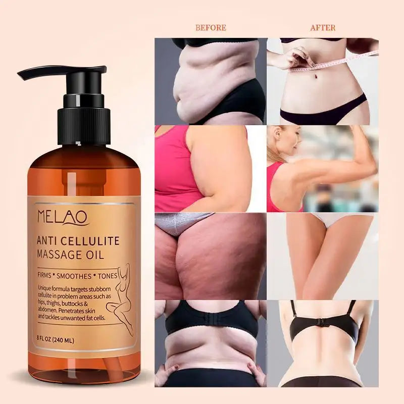 MELAO Anti-Cellulite Massage Oil – Natural Firming & Toning Body Oil with Essential Oils (240ml)
