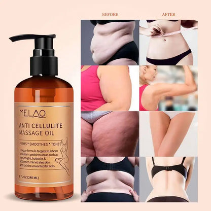 MELAO Anti-Cellulite Massage Oil – Natural Firming & Toning Body Oil with Essential Oils (240ml)