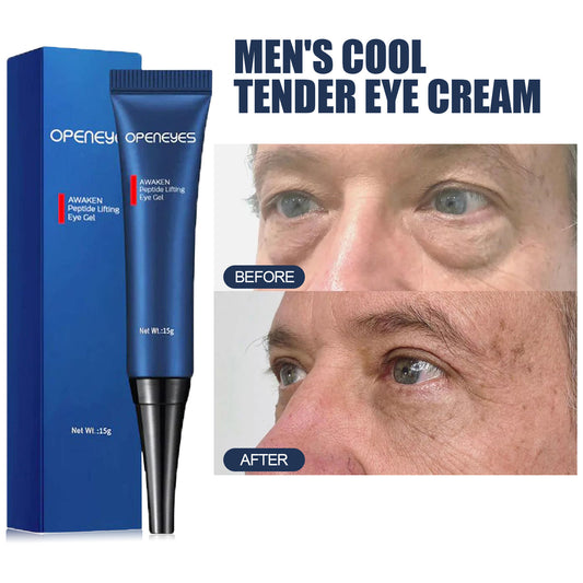 OPENEYES Men's Anti-Aging Eye Cream: Caffeine & Peptide-Powered Dark Circle, Wrinkle & Eye Bag Reducer (15g)