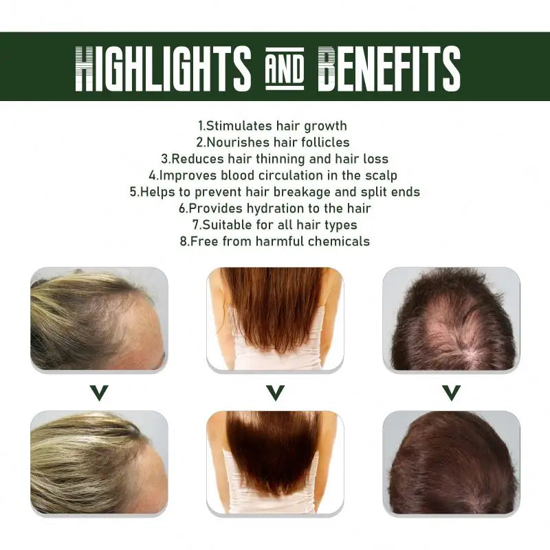 EELHOE Ginger Dense Hair Spray - Nourishing Hair Follicle & Anti-Hair Loss Herbal Support