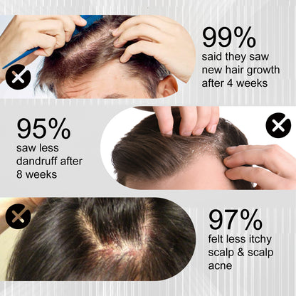 WEST & MONTH Anti-Hair Loss and Hair Strengthening Spray - 100ml
