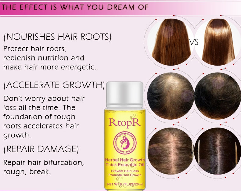 RTOPR Essential Oil Liquid for Rapid Hair Growth and Hair Loss Prevention 20ml