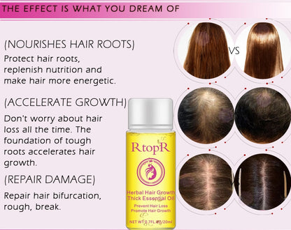 RTOPR Essential Oil Liquid for Rapid Hair Growth and Hair Loss Prevention 20ml