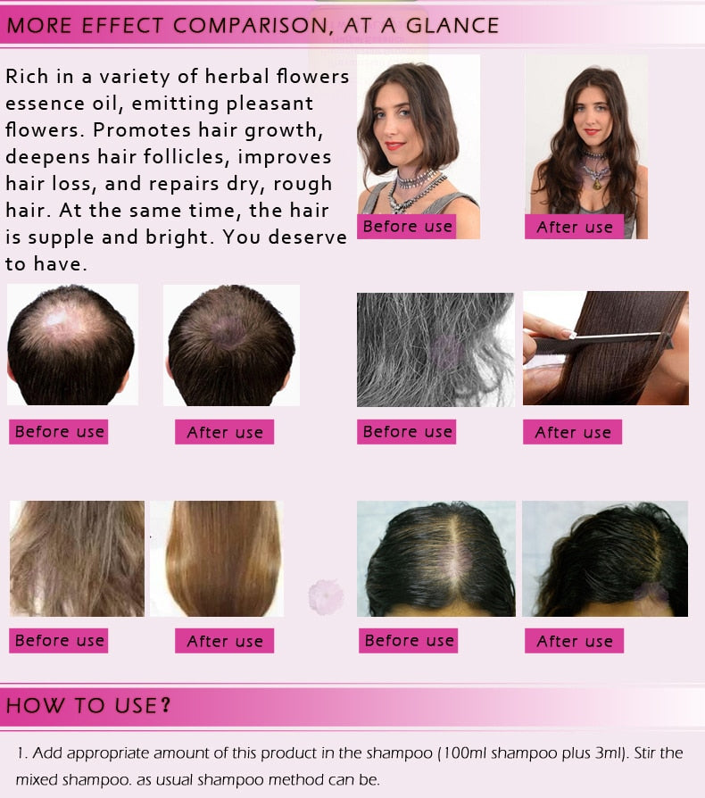 RTOPR Essential Oil Liquid for Rapid Hair Growth and Hair Loss Prevention 20ml