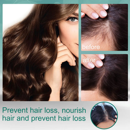 EELHOE Natural Essence Ginger Hair Care for Hair Loss - Restores Hair Follicles, Thicker Hair, 30ml - Buy 3, Pay for 2
