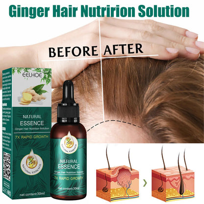 EELHOE Natural Essence Ginger Hair Care for Hair Loss - Restores Hair Follicles, Thicker Hair, 30ml - Buy 3, Pay for 2