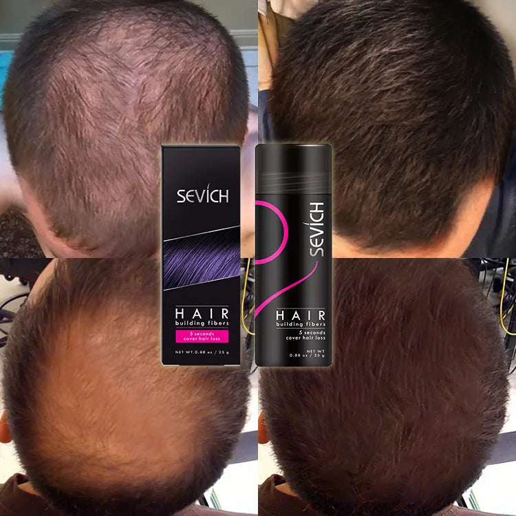 SEVICH Powder Extension Thinning Thickening Hair Growth - Instant Hair Density, Volume Boost Powder