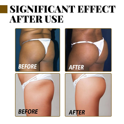 EELHOE Hip Up Essential Oil Buttock Enlargement Cream Effective Lifting & Firming Butt Hip Lift Beauty Big Ass