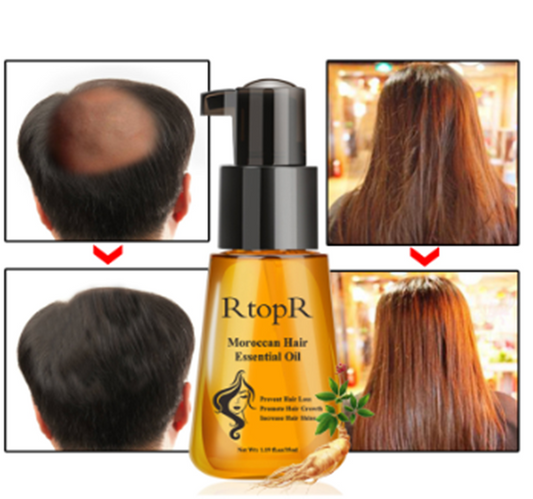 RTOPR Moroccan Essence Hair Serum (Unisex) 35ml - Anti-Hair Loss Herbal Support - Buy 3, Pay For 2