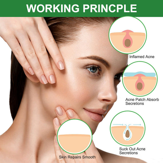 ELAIMEI Advanced Hydrocolloid Blemish Patches – Invisible Day & Night Waterproof Spot Covers (32 Patches)