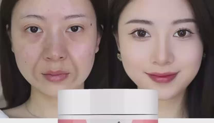 SADOER 4-in-1 Whitening Anti-Aging Cream – Vitamin C, E, Hyaluronic Acid | Dark Spot & Wrinkle Reducing (30g) - Buy 3, Pay For 2