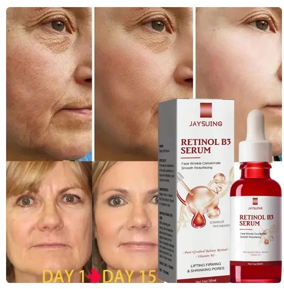 JAYSUNG Retinol Facial Essence – Hydrating & Wrinkle Fading Serum with Hyaluronic Acid (30ml) -  Korean Skin Care Products