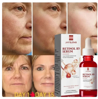 JAYSUNG Retinol Facial Essence – Hydrating & Wrinkle Fading Serum with Hyaluronic Acid (30ml) -  Korean Skin Care Products