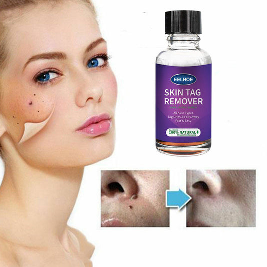 Eelhoe Botanical Skin Tag Smoothing Drops – Natural Thuja Extract Surface Bump & Texture Refiner Liquid