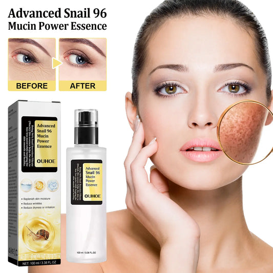 OUHOE Snail 96 Collagen Power Essence Repairs Skin Barrier, Moisturizes And Desalinates Black Spot Snail Essence