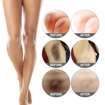 JAYSUING Face, Body and Intimate Area Whitening Snow Bleach Cream Fast Bleaching Brighten Inner Thigh Cream Bleach for Intimate Area