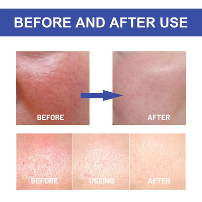 HOYGI Hyaluronic Acid UVA/UVB Strong Protection Liquid Sun Gel SPF50+ PA++++, 50g