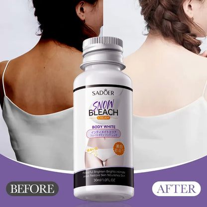 HOGI Whitening Cream Private Parts (Vagina) Underarm Bleaching Serum Whiten Butt Knee Brighten Inner Thigh Intimate Parts Dark Remove Melanin