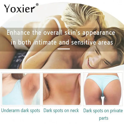 Intimate Area Whitening Cream Brighten Repair Armpit Elbow Buttocks Moisturizing Nourish Nicotinamide Body Skin Care