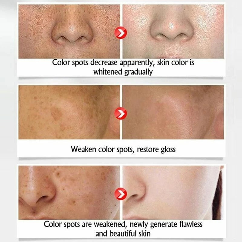 HOREC White Rice Whitening Serum – Anti-Aging, Dark Spot & Acne Remover (15ml)