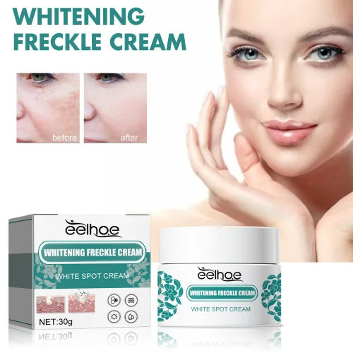 EELHOE Niacinamide Melasma Brightening Cream - Melanin Reducer, Brightening Dark Spot Remover, Freckle Remover, Firming, Fine Line Reducer, Chloasma Face Care - Firming & Anti-Aging Face