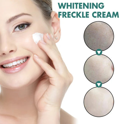 EELHOE Niacinamide Melasma Brightening Cream - Melanin Reducer, Brightening Dark Spot Remover, Freckle Remover, Firming, Fine Line Reducer, Chloasma Face Care - Firming & Anti-Aging Face