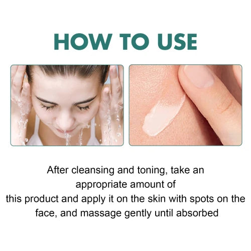 EELHOE Niacinamide Melasma Brightening Cream - Melanin Reducer, Brightening Dark Spot Remover, Freckle Remover, Firming, Fine Line Reducer, Chloasma Face Care - Firming & Anti-Aging Face
