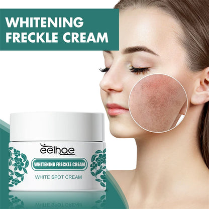 EELHOE Niacinamide Melasma Brightening Cream - Melanin Reducer, Brightening Dark Spot Remover, Freckle Remover, Firming, Fine Line Reducer, Chloasma Face Care - Firming & Anti-Aging Face
